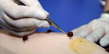 sivasta-kene-vakalari-artiyor-olu-sayisi-3e-yukseldi